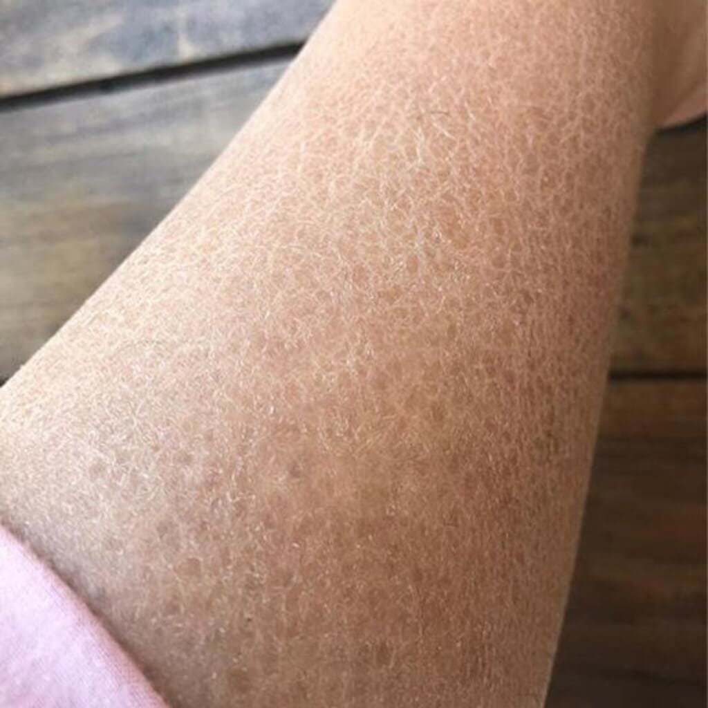 زيت الجسم Balaayah Black Gram Body Booster زيت الجسم iYURA