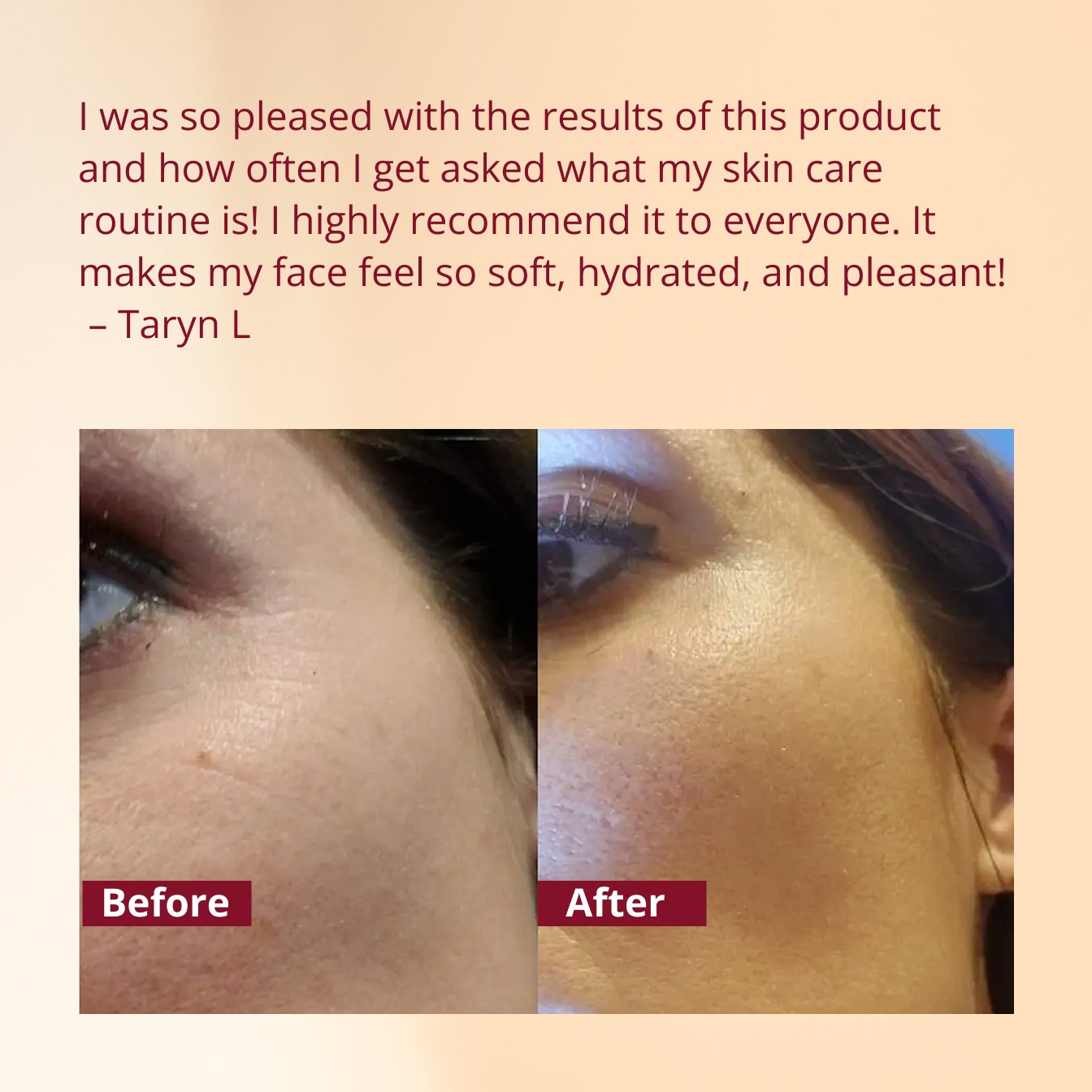 Manjish Glow Elixir – For Uneven Skin Tone & Overnight Glow Boost