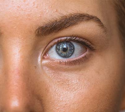 Ayurvedic Products for Oily Skin