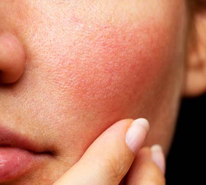 Face Care - Sensitive Skin