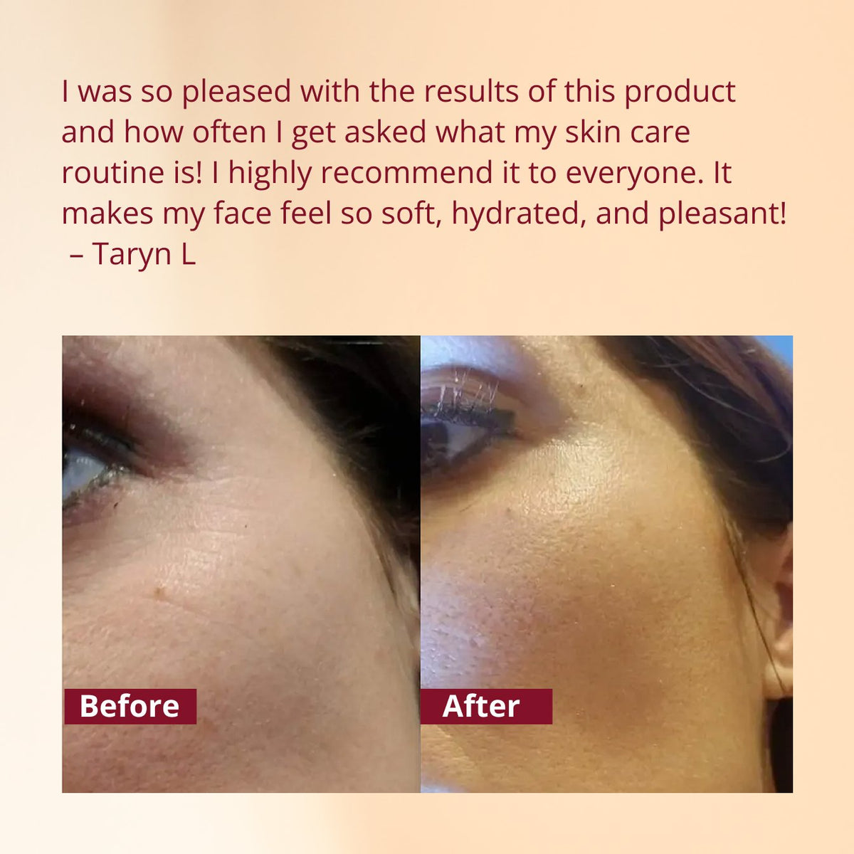 Manjish Glow Elixir – For Uneven Skin Tone &amp; Overnight Glow Boost 